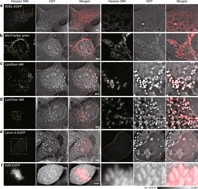 超分辨荧光辅助衍射层析技术揭示细胞器相互作用全景图